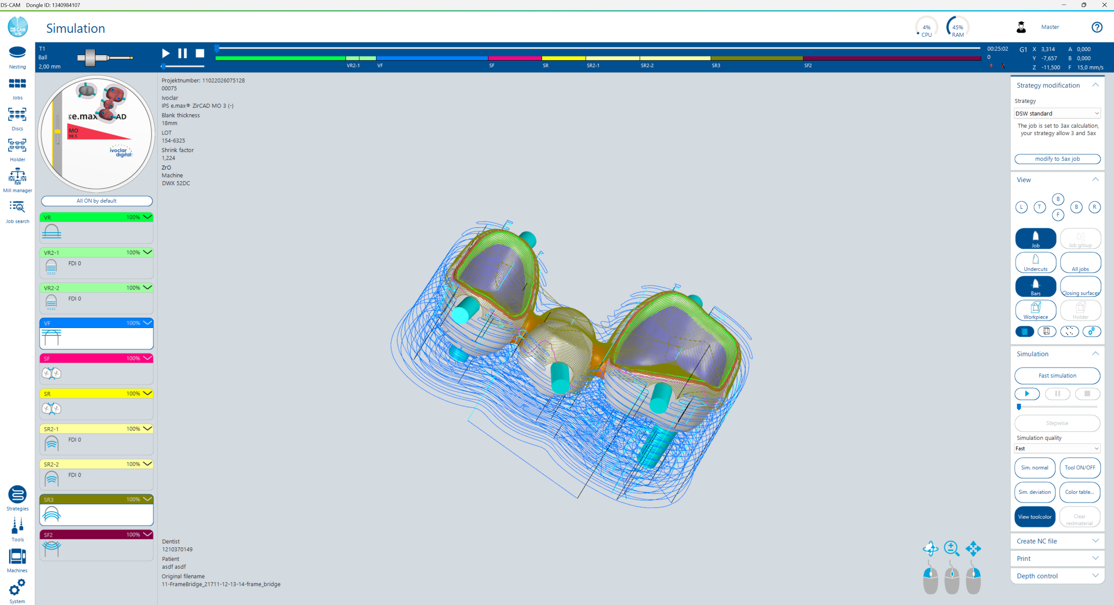 Simulation Dialog – Full Overview